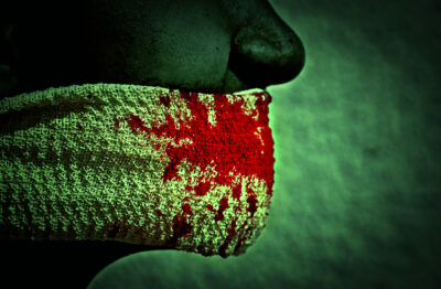 Bleeding